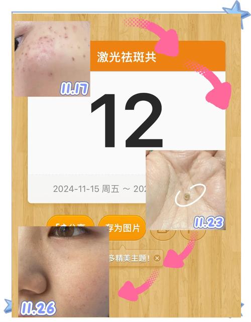女人吃什么祛斑
