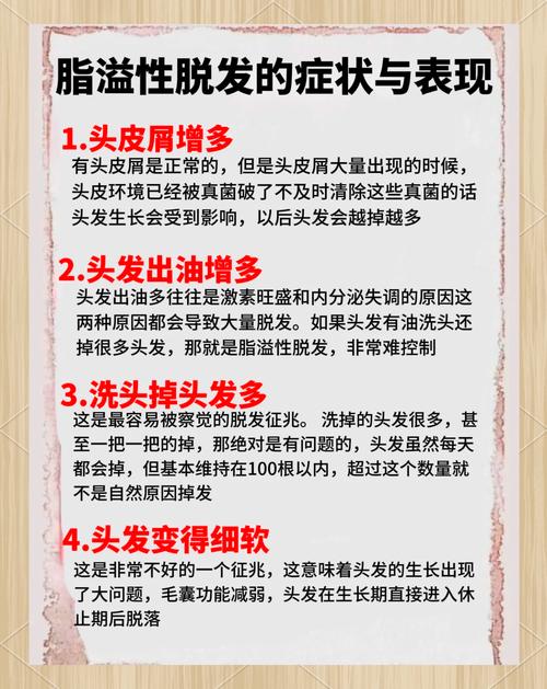 脱发应该注意什么