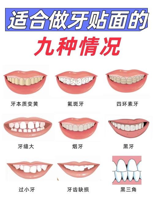 什么是前牙