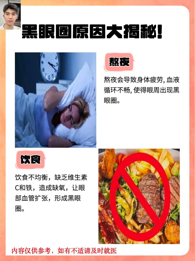 黑眼圈很重是什么原因