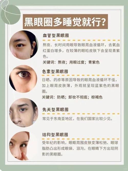 黑眼圈很重是什么原因