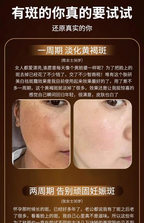 什么牌子祛斑效果好