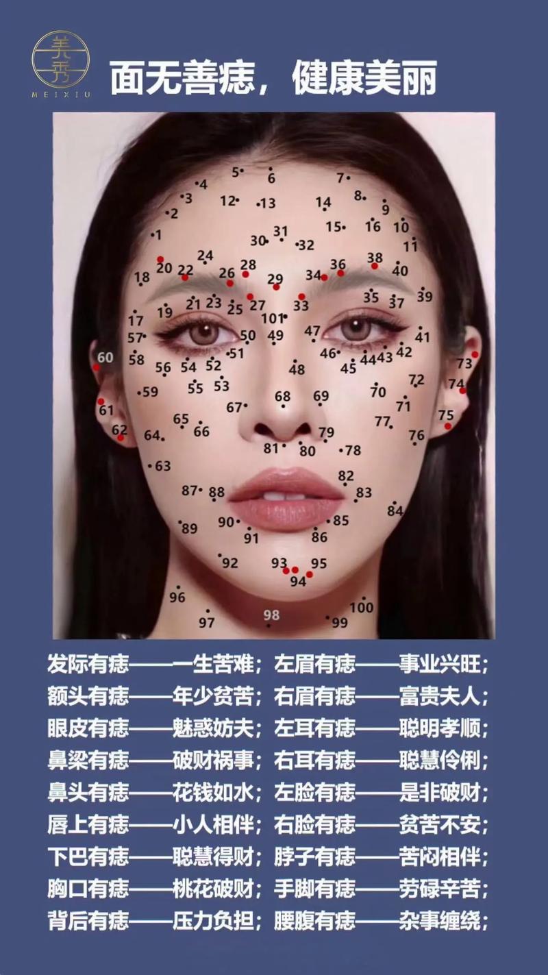 人脸上的痣代表什么