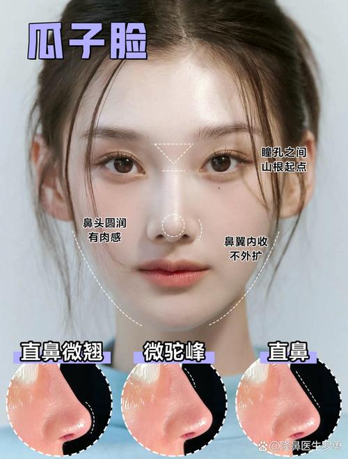 什么是颧骨宽