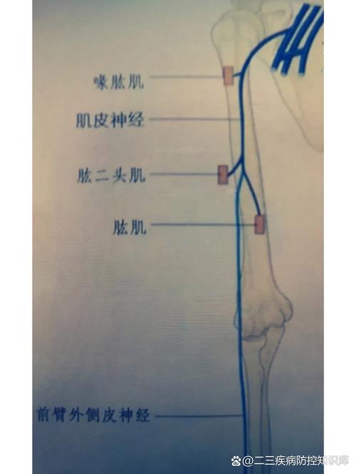 什么是皮肌