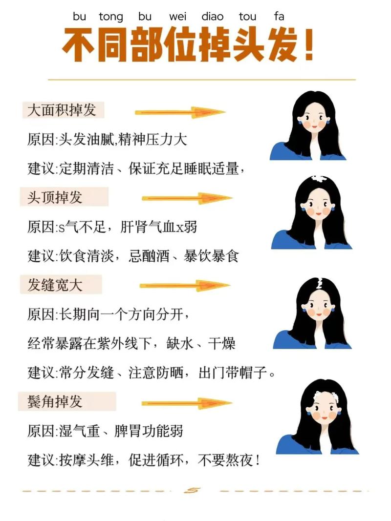 头发为什么一直掉