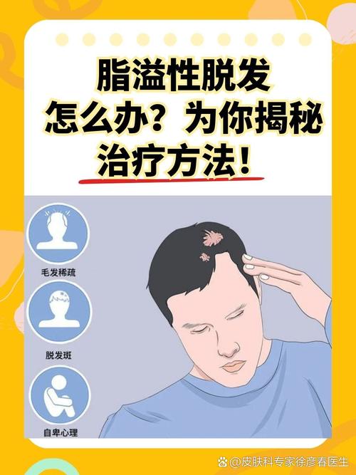 减肥为什么脱发