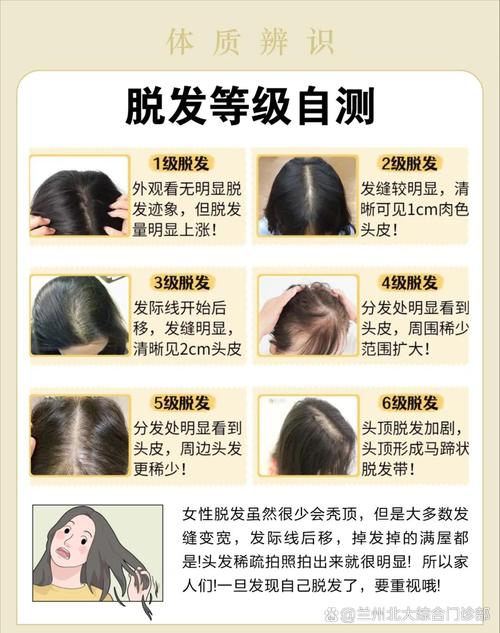 减肥为什么脱发