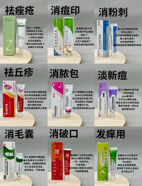 脸上粉刺用什么药膏