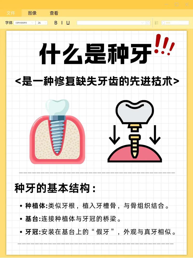 种植牙是什么原理