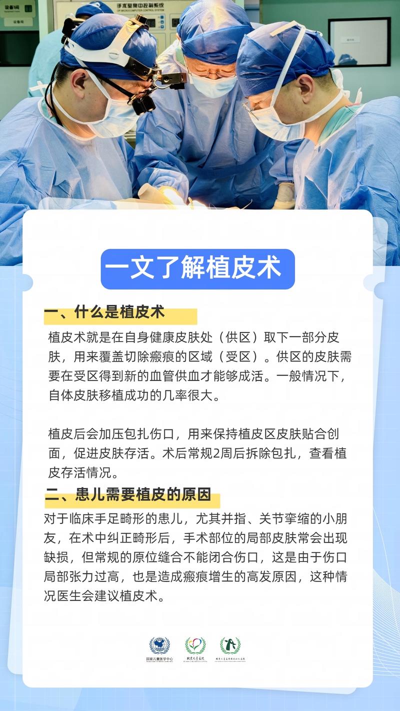什么情况需要植皮
