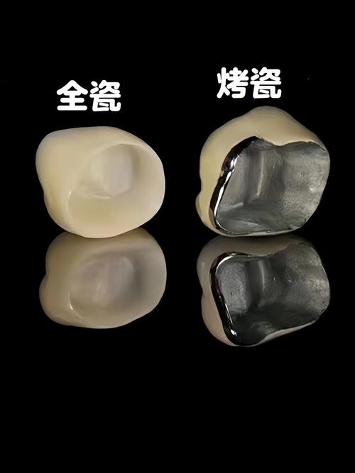 什么是全瓷