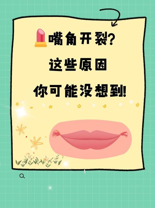 嘴角开裂缺什么