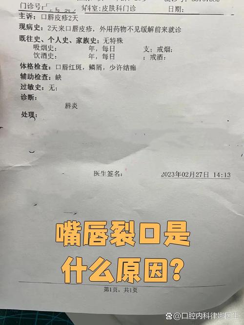 嘴角开裂缺什么