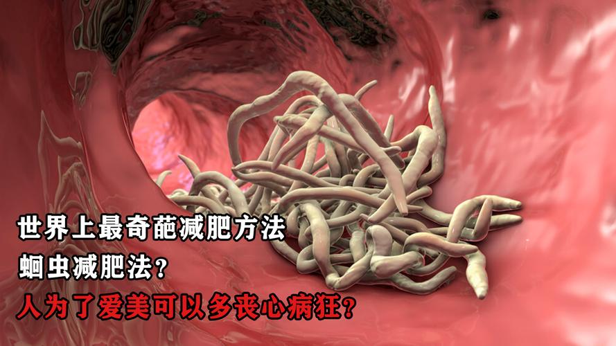 什么是蛔虫减肥