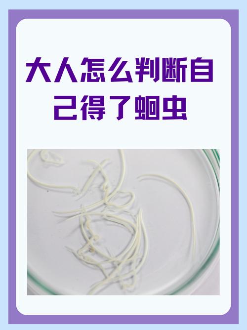 什么是蛔虫减肥