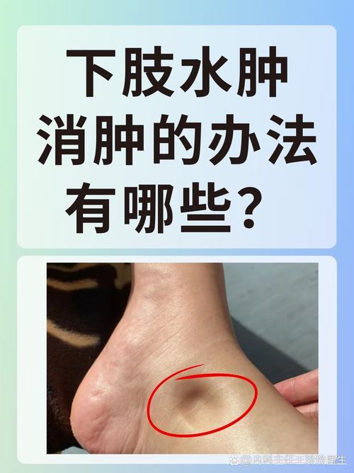 水肿是什么样的图片