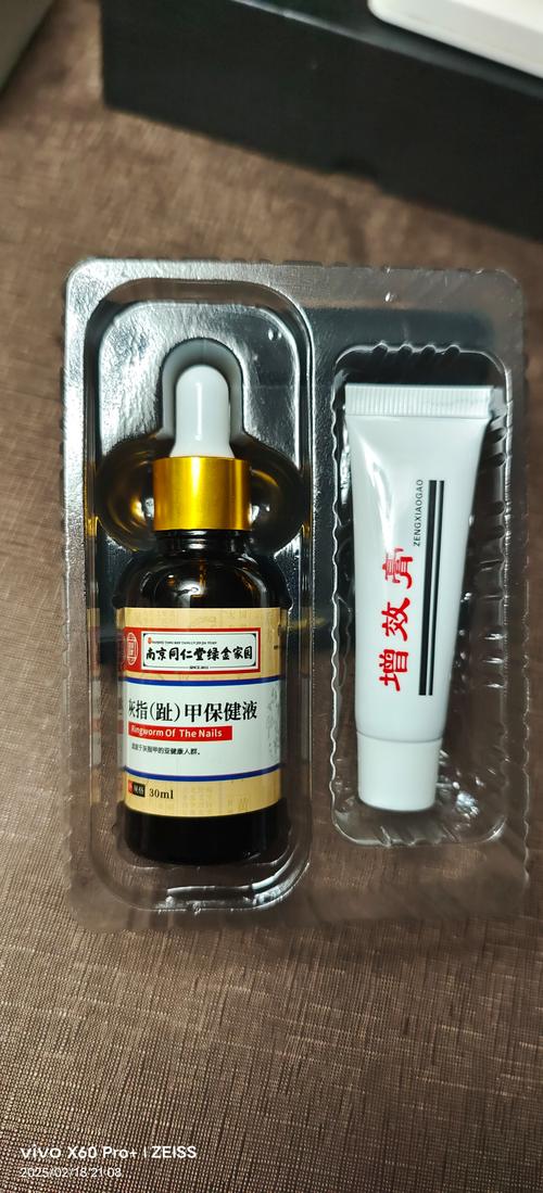 治疗灰指甲什么药好