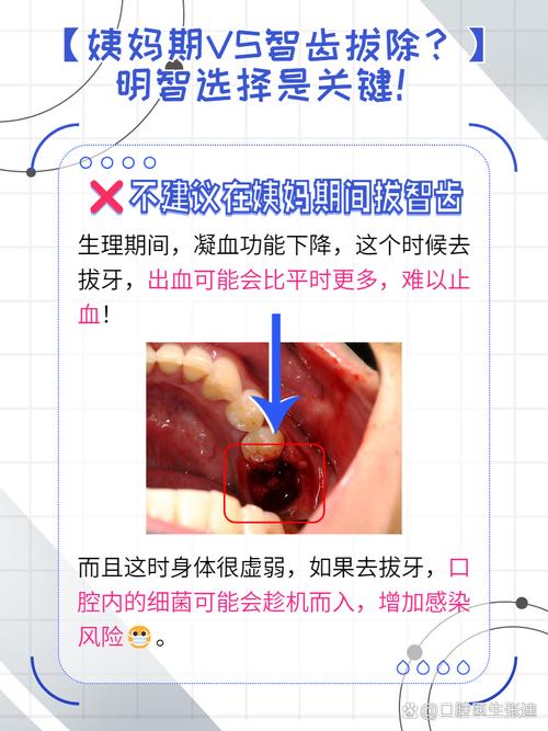 牙疼为什么不能拔