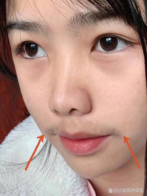 为什么会有唇毛