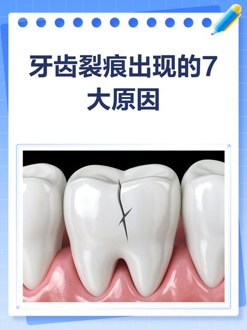 牙齿为什么有裂痕