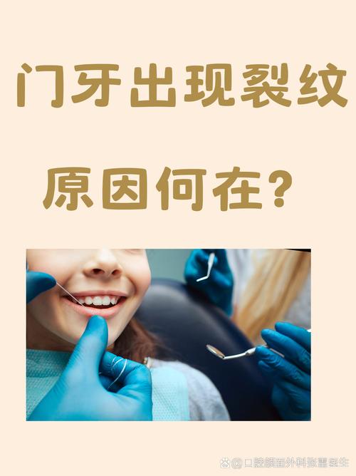 为什么牙齿有裂痕