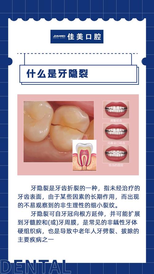 为什么牙齿有裂痕