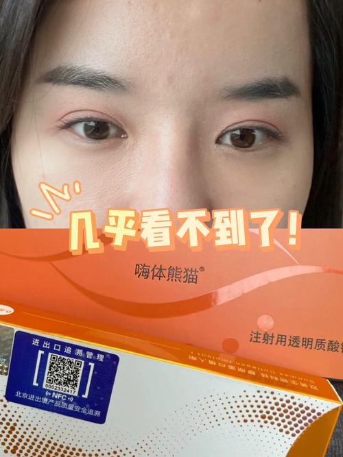 什么是熊猫针
