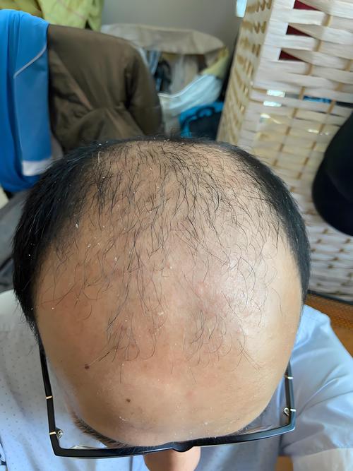 有什么生发的