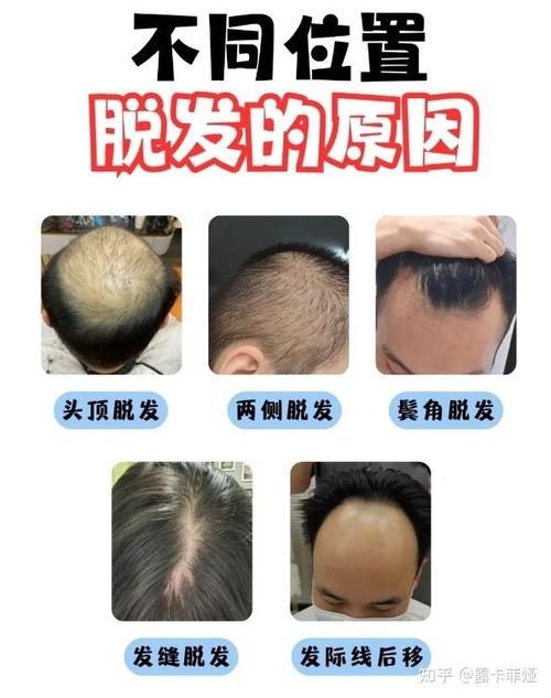 有什么生发的