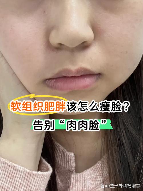 为什么人瘦脸胖