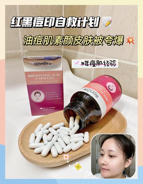 长痘痘可以吃什么药