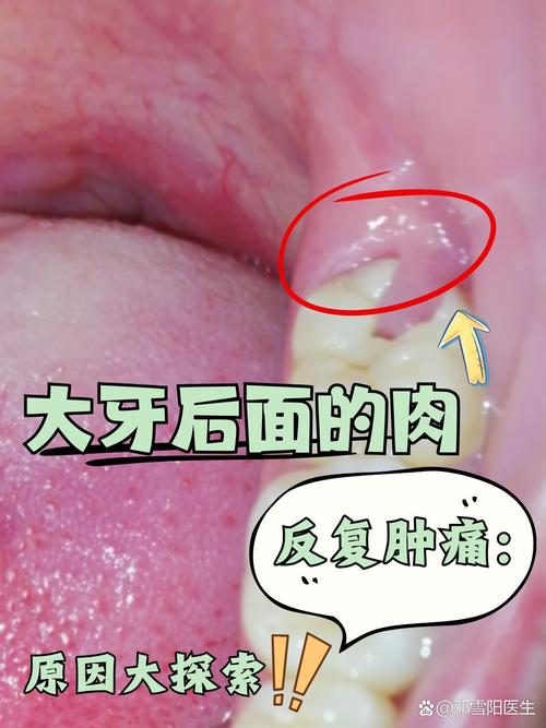 什么是后牙