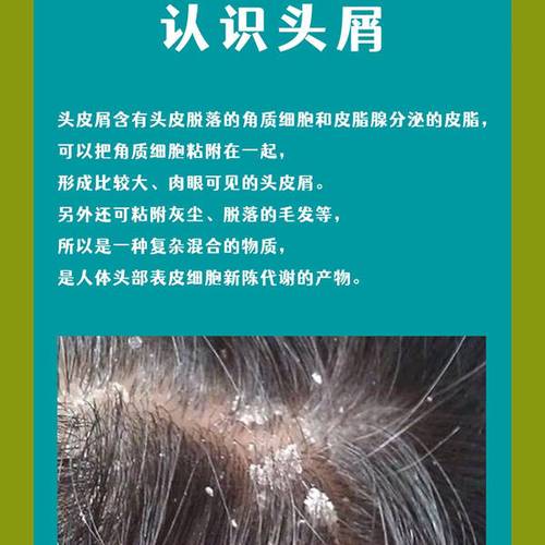 头皮屑多吃什么好
