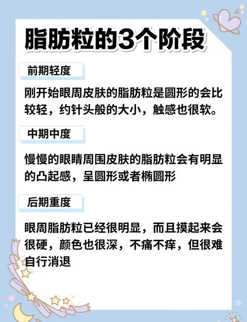 什么可以去除脂肪粒