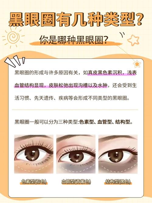 什么遮黑眼圈