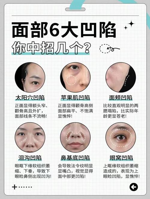 脸部为什么会凹陷