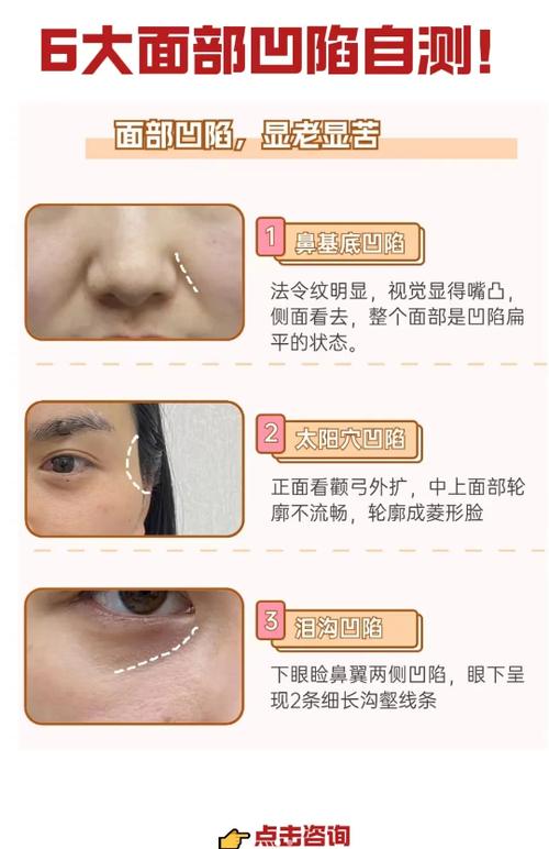 脸部为什么会凹陷