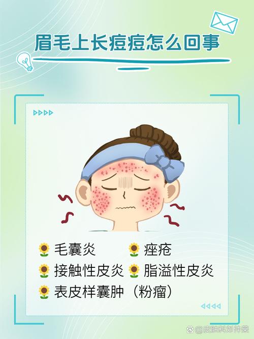 眉毛长痘痘是什么原因
