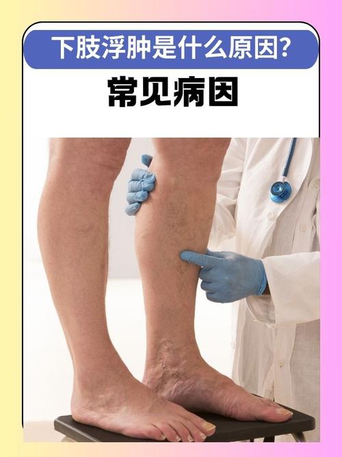 腿有点肿是什么原因