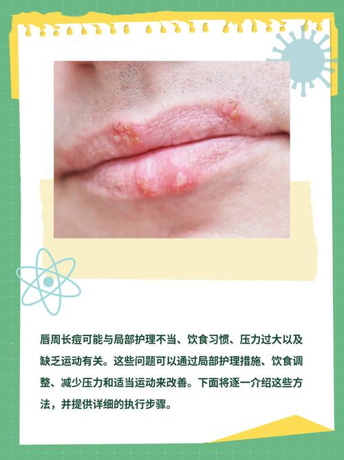 为什么嘴巴周围长痘