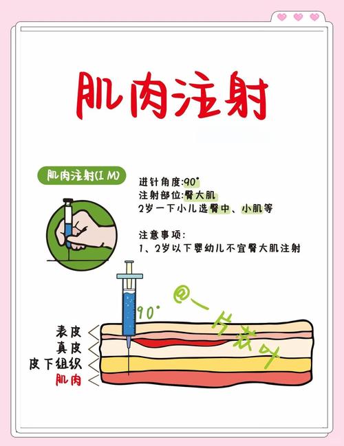 提升针是什么原理