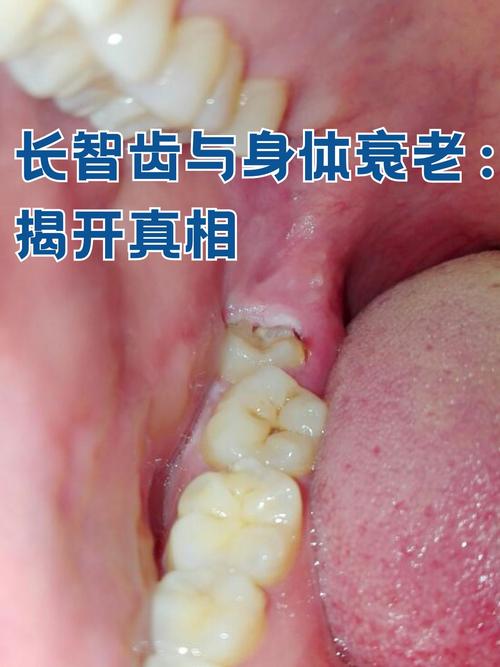 智牙什么时候长