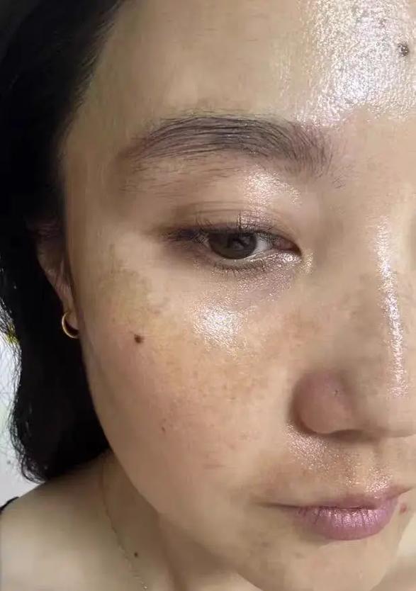 敷什么可以祛斑