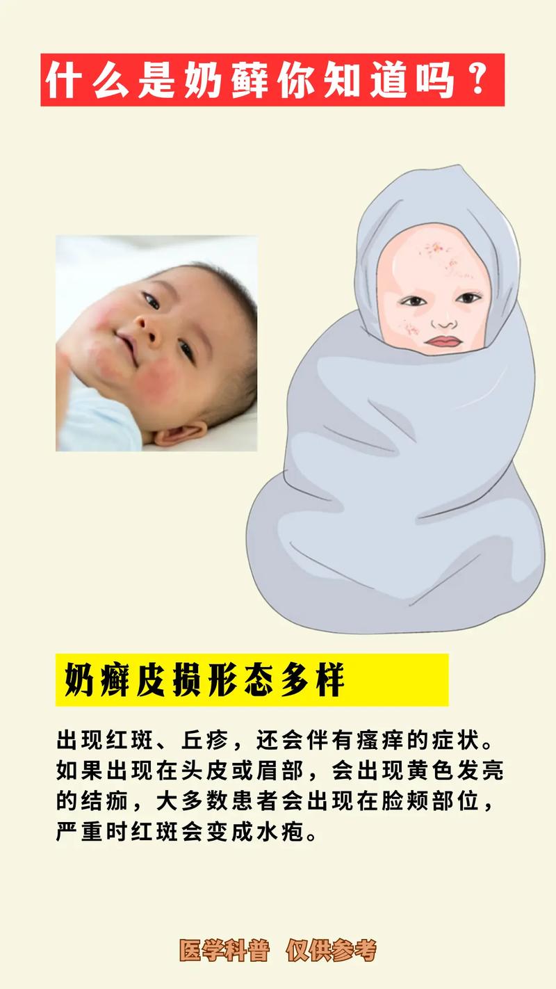 什么是奶湿