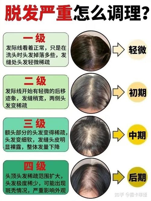 女性掉头发是什么原因