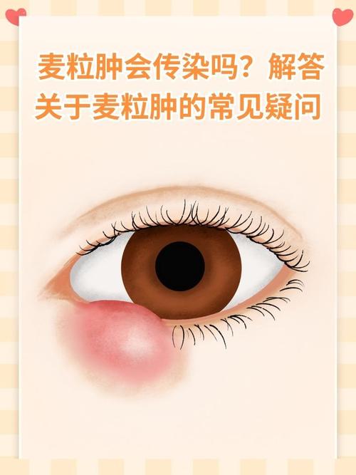 为什么眼睛长麦粒肿