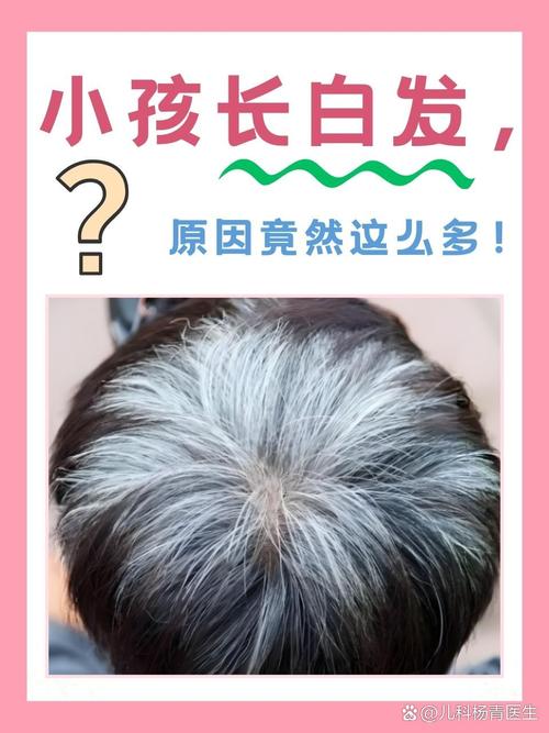 人为什么会白头发