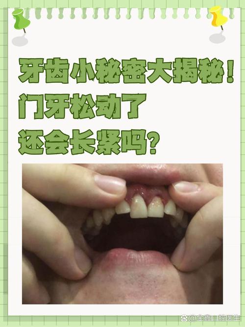 门牙松动是什么原因