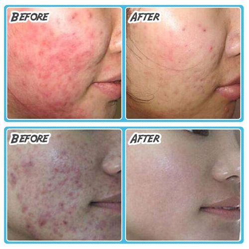 希格修复霜最新消息